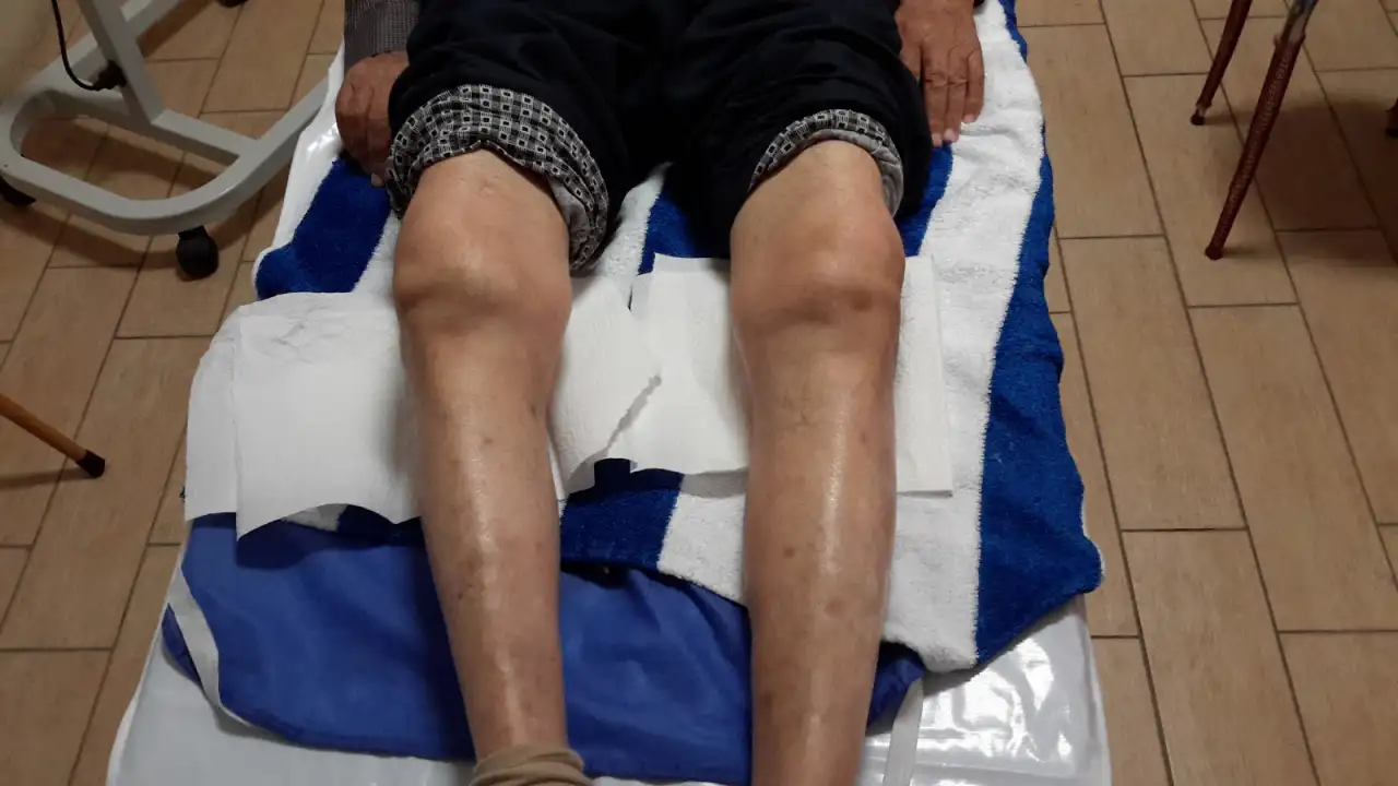 BODRUM ROMATİZMAL HASTALIKLAR SAĞLIK HİZMETLERİ - Nörolojik Rehabilitasyon Merkezi - Muğla - galeri görseli