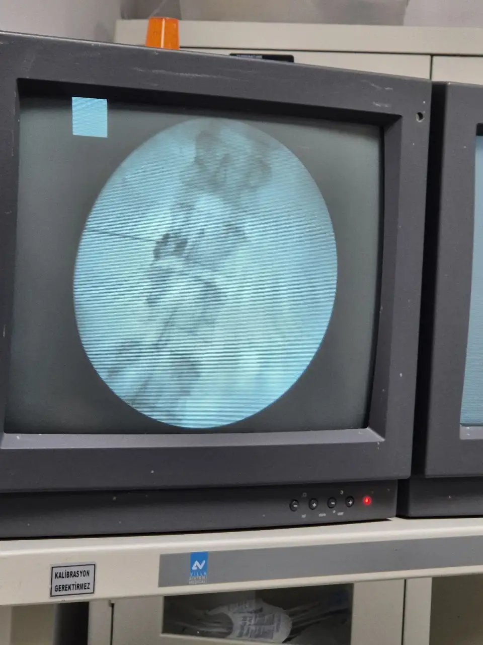Dr. Durukan TÜRE | Adana Fizik Tedavi - Nörolojik Rehabilitasyon Merkezi - Adana