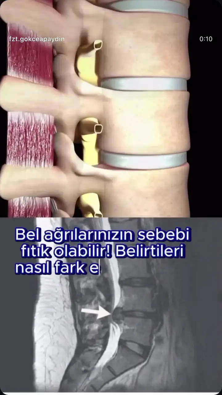 Tuzla Fizyoterapi | Uzm. Fzt. Gökçe Apaydın